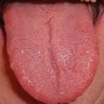 Human_Tongue