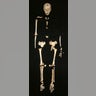 Homo Floresiensis Skeleton