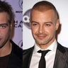 Joey_Lawrence_Hairloss