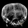 CT Scan of King Tut