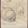 The Skull of Richard II