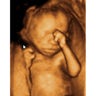 Ultrasound Image