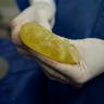 Venezuela_Breast_Implants_2