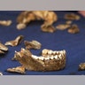 Skeletal fragments