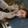 Syrian doctor treats a child following a suspected chemical attack.