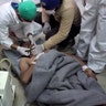 A victim of a suspected chemical attack as he receives treatment at a makeshift hospital.