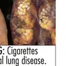 Smokinglabel_FDA_lung