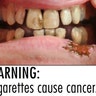 Smokinglabel_FDA_teeth