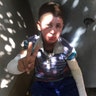 A young boy with a burned face shows the peace sign, May 5, 2017