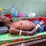 A prisoner, too weak to stand, lies in the prison infirmary at the National Penitentiary in downtown Port-au-Prince, Haiti