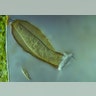 protozoan_pyxicola