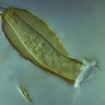 protozoan_pyxicola