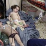 Medical workers treat toddlers following a suspected poison gas attack in the opposition-held town of Douma.