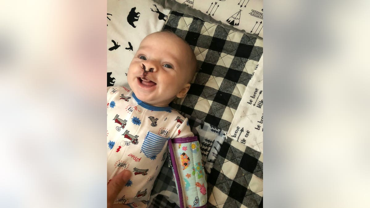 Cam's cleft lip and palate were not detected in mom Sara's sonograms.