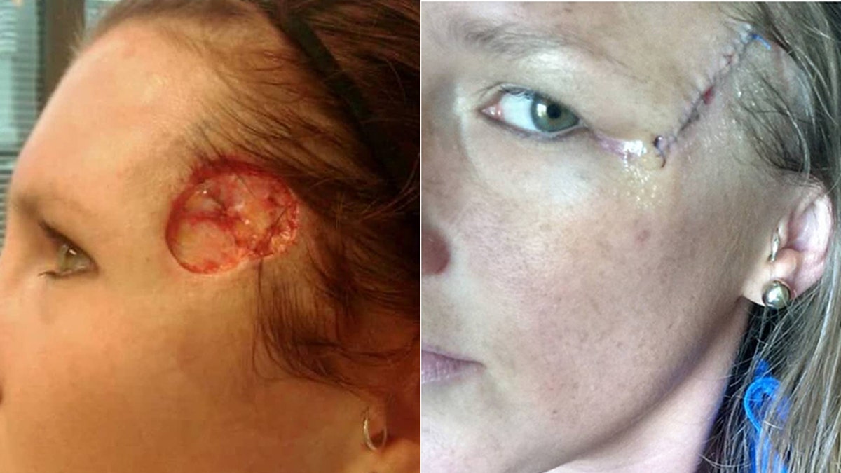 Doles said the procedures left her with severe headaches and facial paralysis.