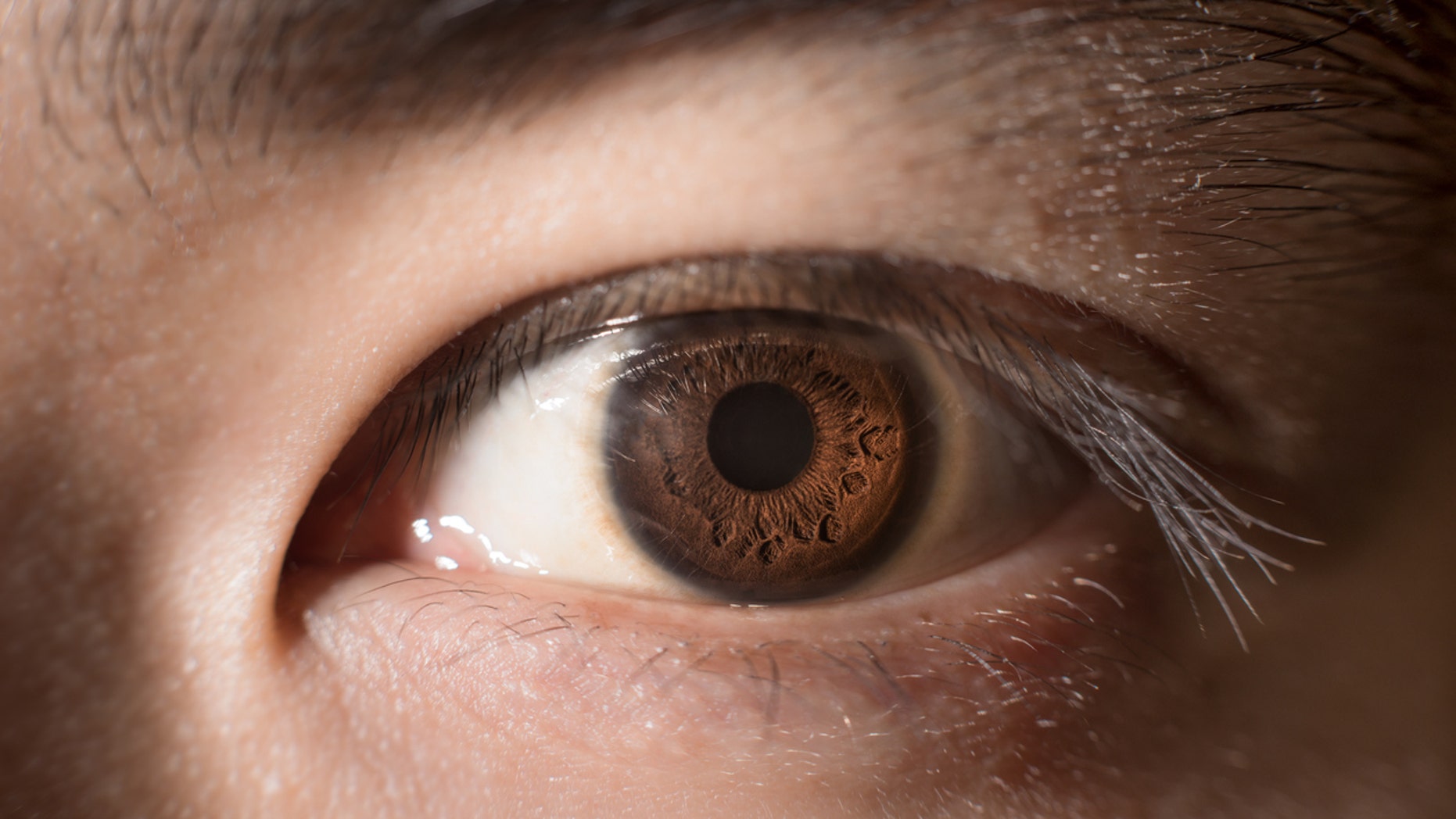 Eye-iStock.jpg