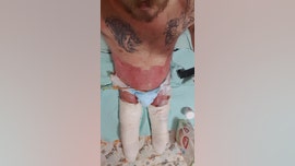 Indiana man who lost legs, penis in drunk driving crash still recovering 2 years later