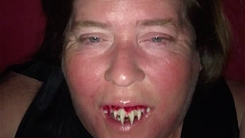 Alabama woman’s zombie Halloween costume turns into medical nightmare after $3 fake teeth get stuck