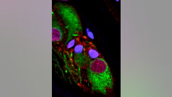 Appendix removal is linked to lower risk of Parkinson's