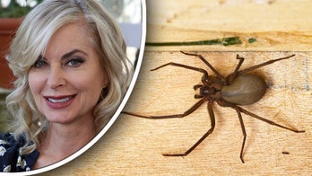 'Young and the Restless' star reveals 'creepy' brown recluse spider bite