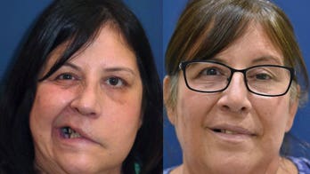 Stroke patient's smile restored after pioneering surgery