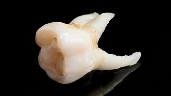 Georgia construction workers find roughly 1,000 human teeth hidden inside wall