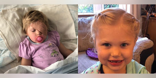 Alice Taylor, 2, was diagnosed with a rare eye cancer shortly after playing a game of pirates with her mom.