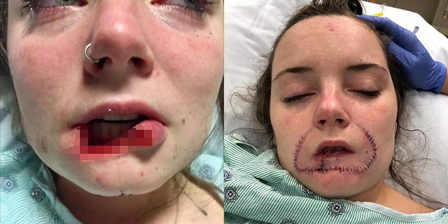 The South Carolina woman said when she saw what her face looked like she joked she "wouldn't have to dress up for Halloween to scare everybody."