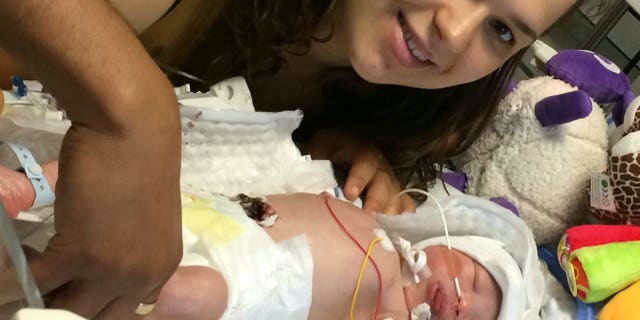 IIszak Derby has been diagnosed with cerebral palsy and epilepsy as well as hearing and sight problems following his birth in June.