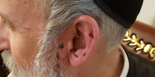 The Brooklyn District Attorney’s Office said Schwartz suffered cuts to the lip, tongue and ear, bleeding from the mouth, swelling to the hand and scratches to the foot and head during the attack.
