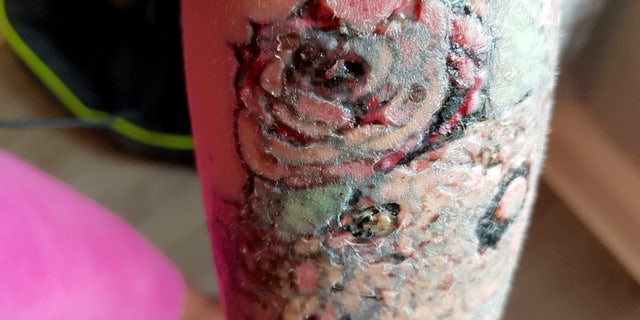 Lynn said the shop hasn't responded to her request to see tattoo removalist certificates for three weeks.