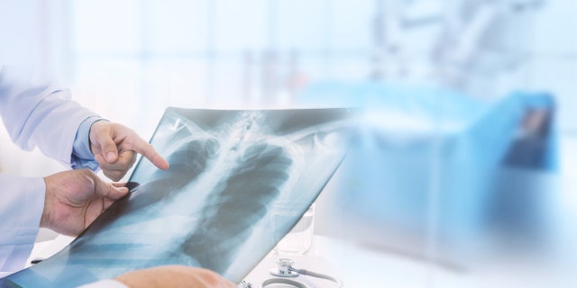 Doctors examine a lung radiograph X-ray film of a patient.