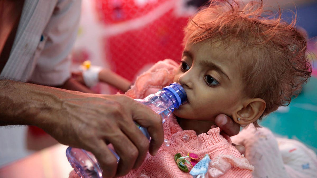 FILE: A father gives water to his malnourished daughter at a feeding center in a hospital in Hodeida, Yemen.