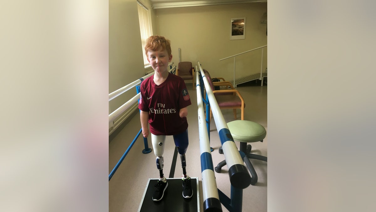 Marshall Janson, 10, is learning to walk again with brand new prosthetic limbs that allow him to bend his legs for the first time.