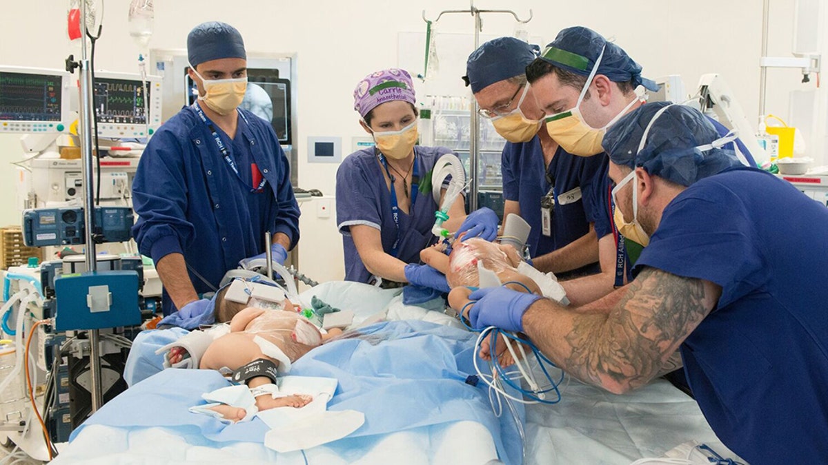 The girls were separated for the first time in a six-hour surgery at Melbourne's Royal Children's Hospital.