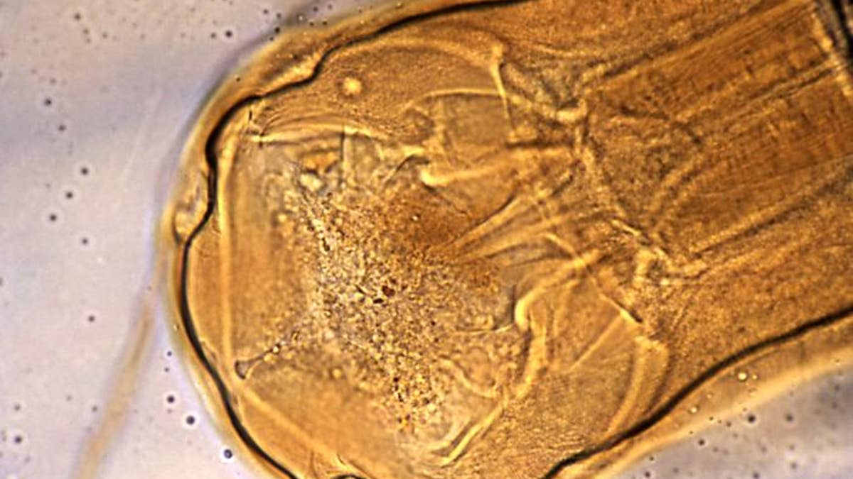Head of Necator americanus (hookworm), and its mouth’s cutting plates.
