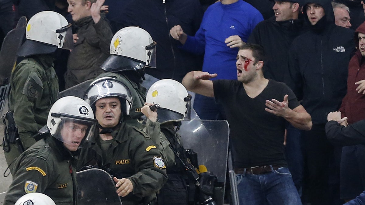 Shocking photos show the officers whacking the Dutch supporters with batons, leaving individuals with gruesome cuts.<br data-cke-eol="1">