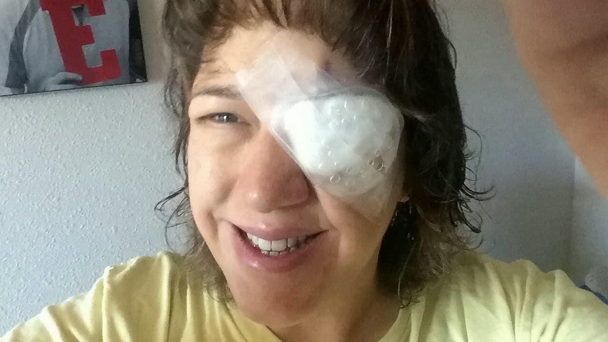 Peoples, 49, was left without vision in her left eye after contracting acanthamoeba keratitis, a rare infection in which an amoeba attacks the outer layer of the eye.