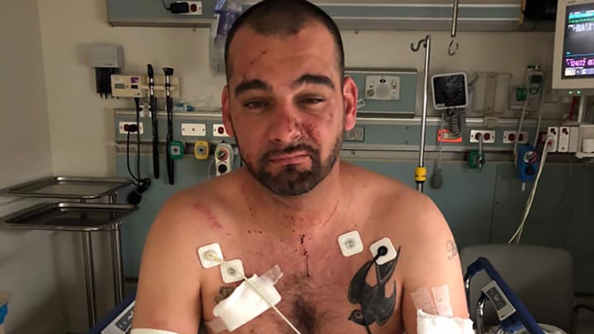 Josh Davis, a 36-year-old Red Sox fan, was brutally assaulted by whom he believes were a group of Dodgers fans after Boston won the World Series Sunday night in Los Angeles.