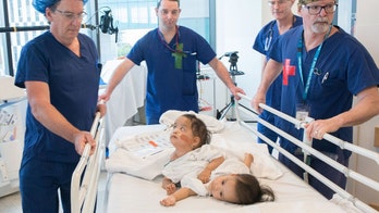 Conjoined twins successfully separated in 6-hour surgery