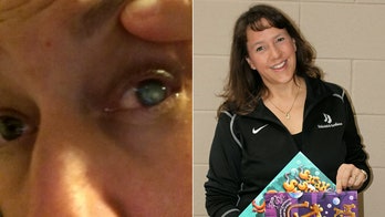 Mom temporarily blinded by parasite after swimming with contacts