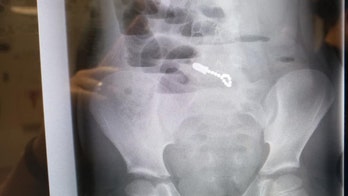 Utah boy accidentally swallows fidget magnets while hiding toy from brother, family says