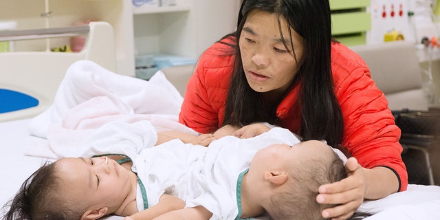 The girls, pictured with their mother before the surgery, are now breathing on their own.