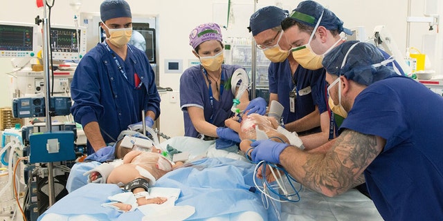 The girls were separated for the first time in a six-hour surgery at Melbourne's Royal Children's Hospital.