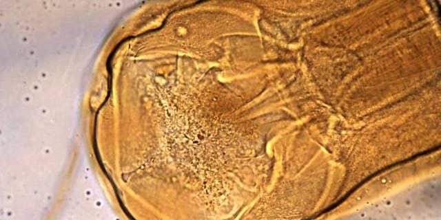 Head of Necator americanus (hookworm), and its mouth’s cutting plates.