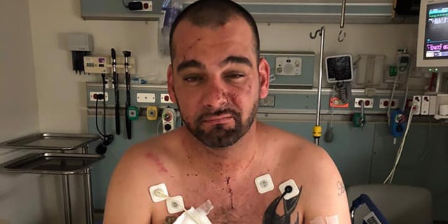 Josh Davis, a 36-year-old Red Sox fan, was brutally assaulted by whom he believes were a group of Dodgers fans after Boston won the World Series Sunday night in Los Angeles.