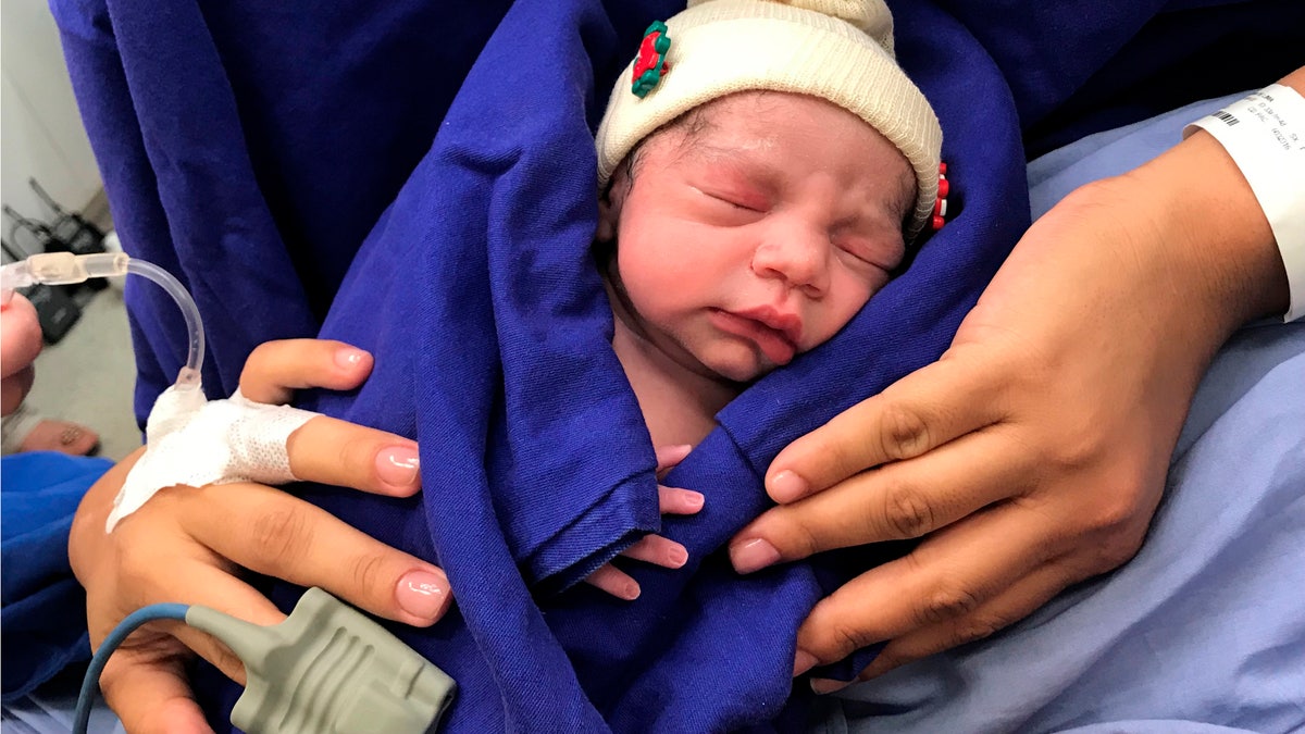 This Dec. 15, 2017 photo provided by transplant surgeon Dr. Wellington Andraus shows the baby girl born to a woman with a uterus transplanted from a deceased donor at the Hospital das Clinicas of the University of Sao Paulo School of Medicine, Sao Paulo, Brazil, on the day of her birth. 