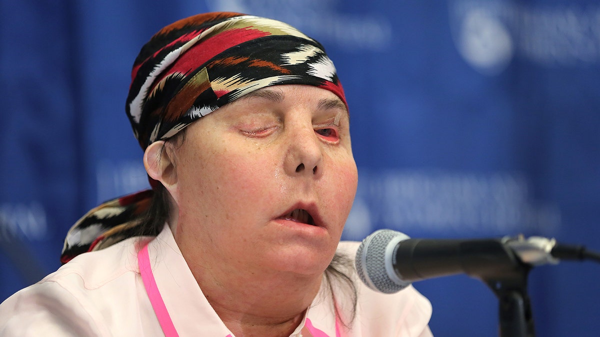 Carmen Blandin Tarleton speaks at a May 2013 press conference at Brigham and Women's Hospital following her face transplant surgery. 