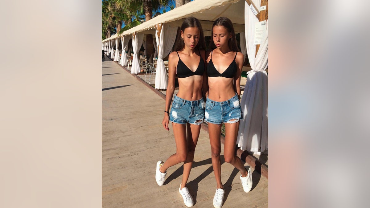 Daria and Maria Ledeneva were diagnosed with severe anorexia and their condition was defined as critical.