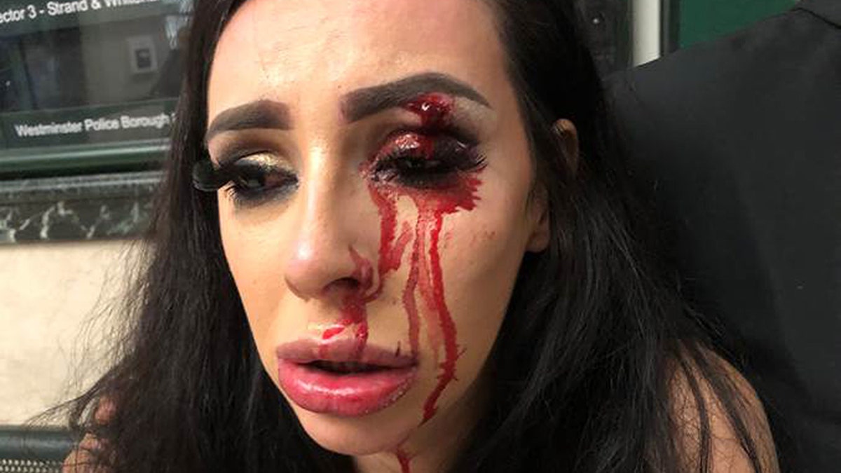 Stevenson said she was left almost blind after she was robbed.